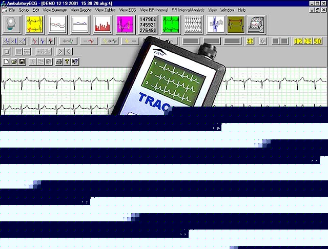 New 8 holter monitors, arrhythmia analysis program, .