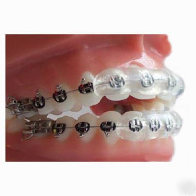 New dental orthodontic bracket lip guard protector 