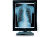 Barco mgd 221 portrait crt grayscale medical monitor
