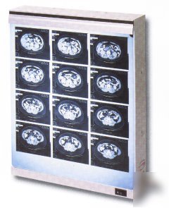 Wolf x-ray econoline illuminator, standard 14